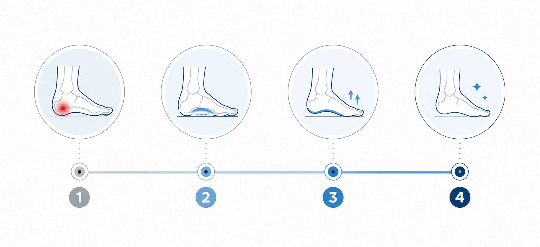 Linha do tempo ilustrando as fases de recuperação da fascite plantar, da fase aguda até a melhora completa